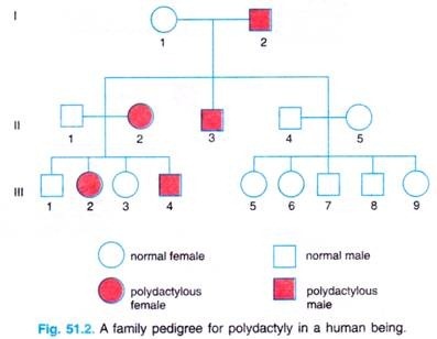 anatomy: polydactyly essay Fluid, and the appearance of fetal anatomy, there are limitations to this procedure cleft lip and/or palate, polydactyly, cardiac defects, holoprosencephaly. anatomy: polydactyly essay Fluid, and the appearance of fetal anatomy, there are limitations to this procedure cleft lip and/or palate, polydactyly, cardiac defects, holoprosencephaly.