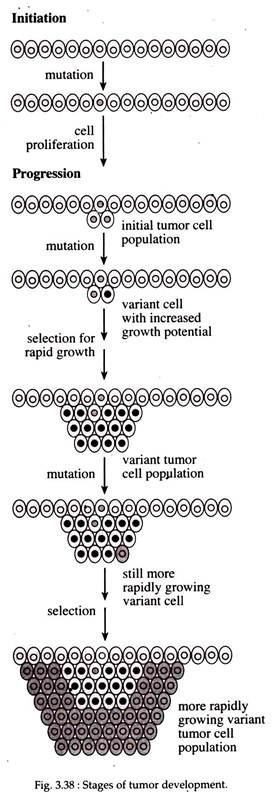 Stages of Tumor Development