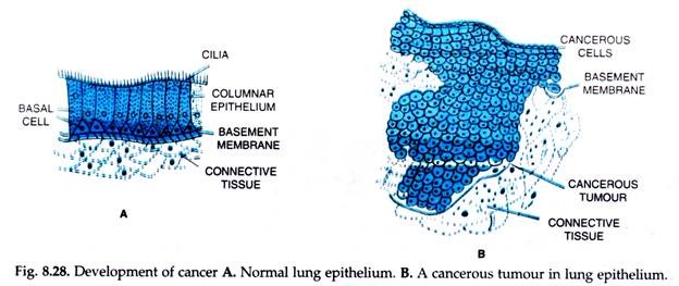 Development of Cancer