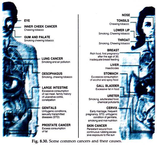 Some Common Cancers and their Causes