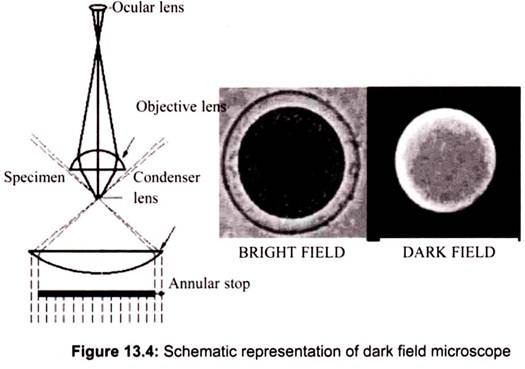 Schematic Representation of Dark Field Microscope